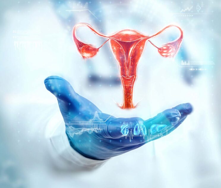 PCOS