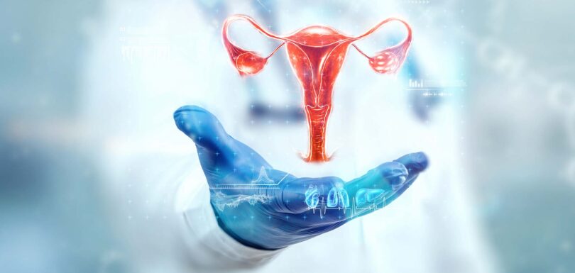 PCOS